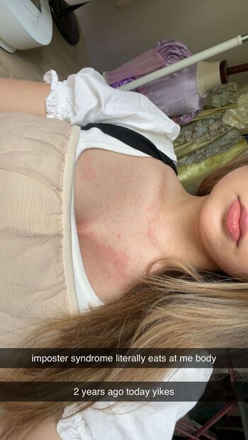 🔥 Ester dobrik page leaked private photo uncensored full