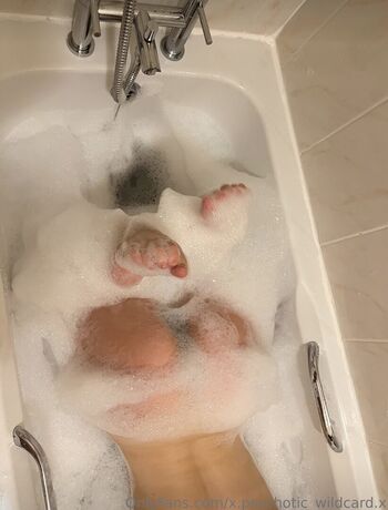 🔥 X psychotic wildcard x leaked private photo uncensored full