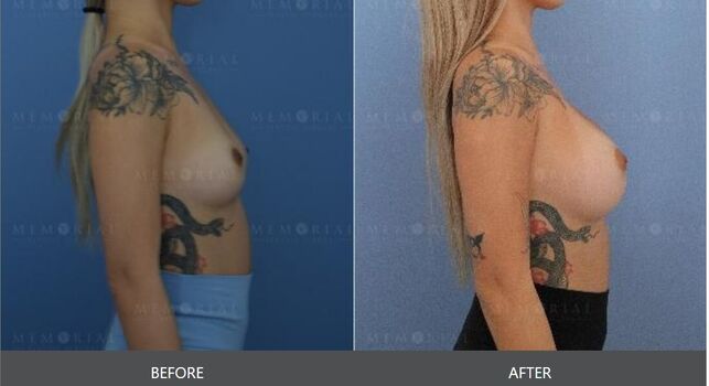 🔥 Yoshibaby  page leaked private photo uncensored full